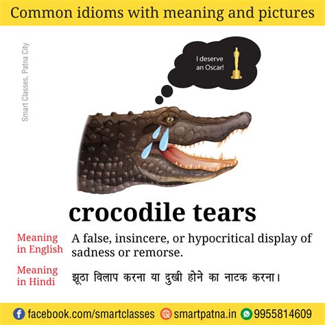 INTRODUCTION: Crocodile tears syndrome (CTS) is a synkinesis-type sequela seen after facial paralysis.CTS is characterized by hyperlachrymation while feeding. 1,2 Botulinum toxin A (BTxA) has been used as a treatment for CTS patients. The BTxA mechanism of action in the lacrimal gland is the presynaptic blockade of acetylcholine release at cholinergic …